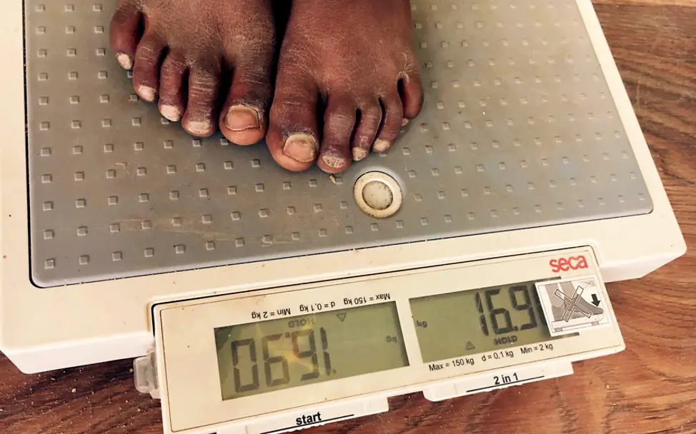 Habid auf einer Waage | © UNICEF/DT2016-49861 Irak: Habid lässt sich wiegen