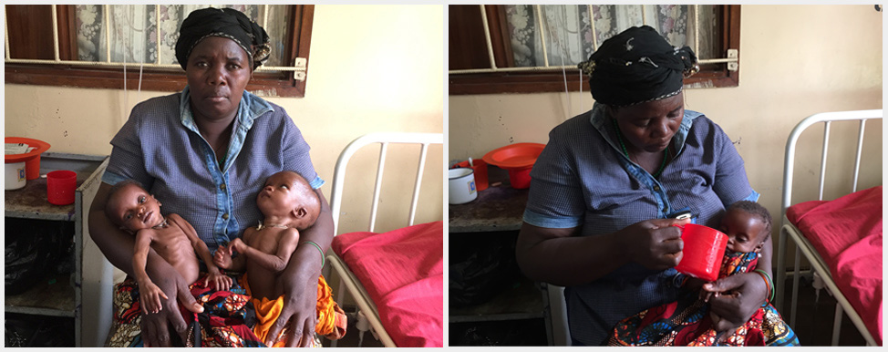 Malawi-Mangelernaehrung Malawi-Mangelernaehrung