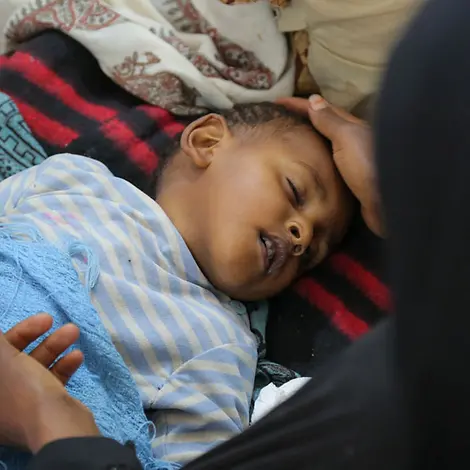 Jemen im Mai 2017: Dieses an Cholera erkrankte Kind leidet unter starkem Durchfall.