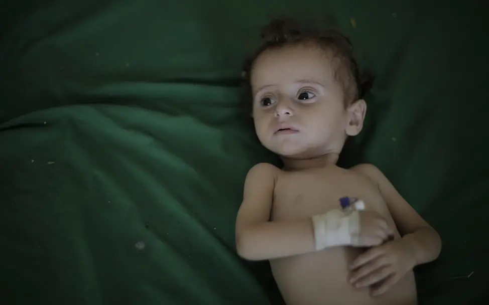 Jemen: Über elf Millionen Kinder sind auf humanitäre Hilfe angewiesen. | © UNICEF Yemen/Ahmed Jemen: Ein Kind liegt auf einem Krankenhauslaken.