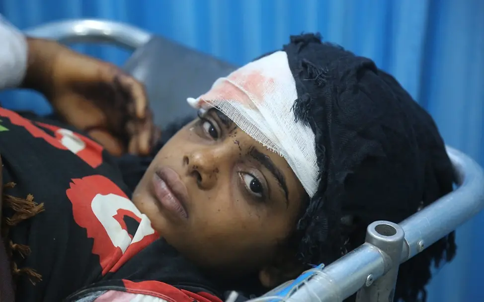 Ein verwundetes Mädchen wird im Althawra Krankenhaus in Hodeidah behandelt. | © UNICEF/Ayyashi Jemen: Ein Mädchen liegt mit Kopfverband auf einer Liege im Krankenhaus.