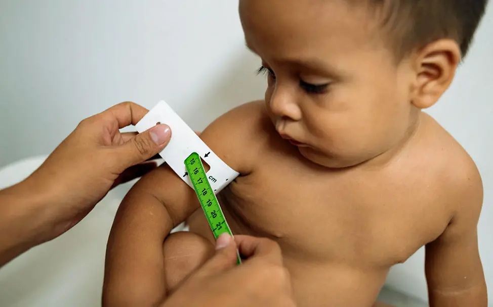 Check auf Mangelernährung: Ein Maßband zeigt an, wenn ein Kind unterernährt ist. | © UNICEF/Arcos Venezuela Hunger: Viele Kinder in Venezuela haben aktuell nicht genug zu essen.