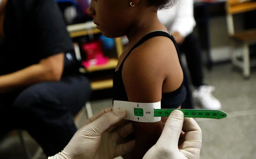 Check auf Mangelernährung: Ein Maßband zeigt an, wenn ein Kind unterernährt ist. | © UNICEF/Fernandez Venezuela Hunger: Viele Kinder in Venezuela haben aktuell nicht genug zu essen.