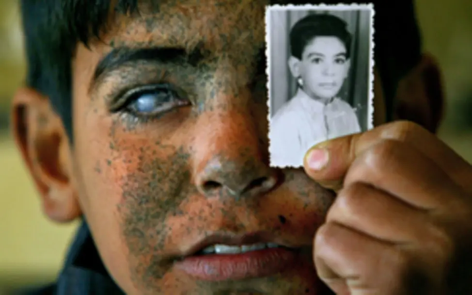 2. Preis: Nach dem Irak Krieg | © Maurício Lima, Brasilien 2. Preis Foto des Jahres 2005: Nach dem Irak Krieg