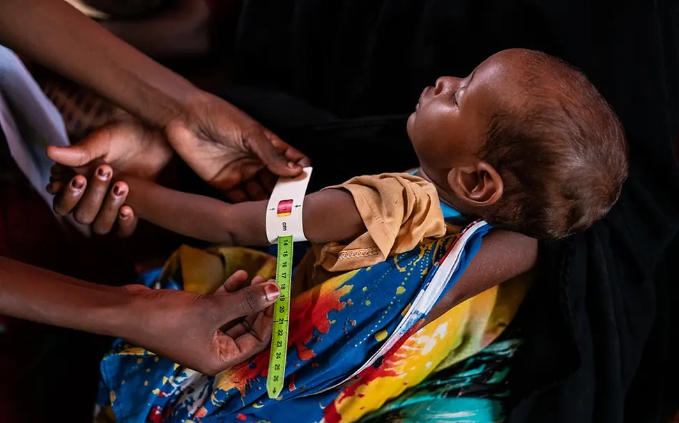 Ein Kind in Somalia wird durch Messung des Oberarmumfangs auf Unterernährung untersucht. | © UNICEF/Knowles-Coursin Um eine Mangelernährung feststellen zu können, wird von einem Kind in Somalia der Oberarmumfang gemessen.
