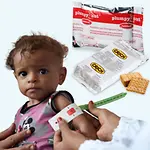 Spenden Sie Zukunft mit dem kleinen Ernährungspaket