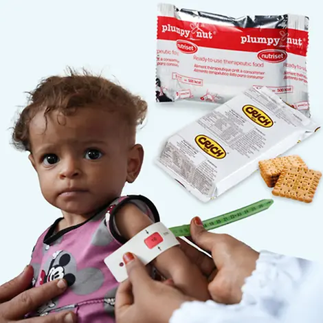 Spenden Sie Zukunft mit dem kleinen Ernährungspaket