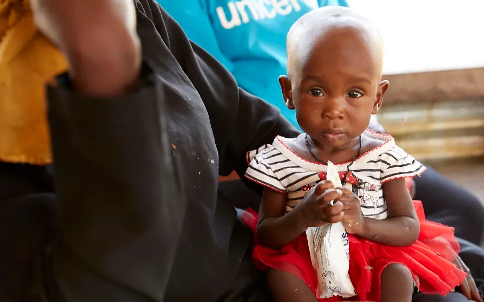 Südsudan: Amira (9 Monate). | © UNICEF/Wilson Südsudan: Die neun Monate alte Amira sitzt auf dem Schoss ihrer Mutter und hält eine Tüte Erdnusspaste in den Händen.