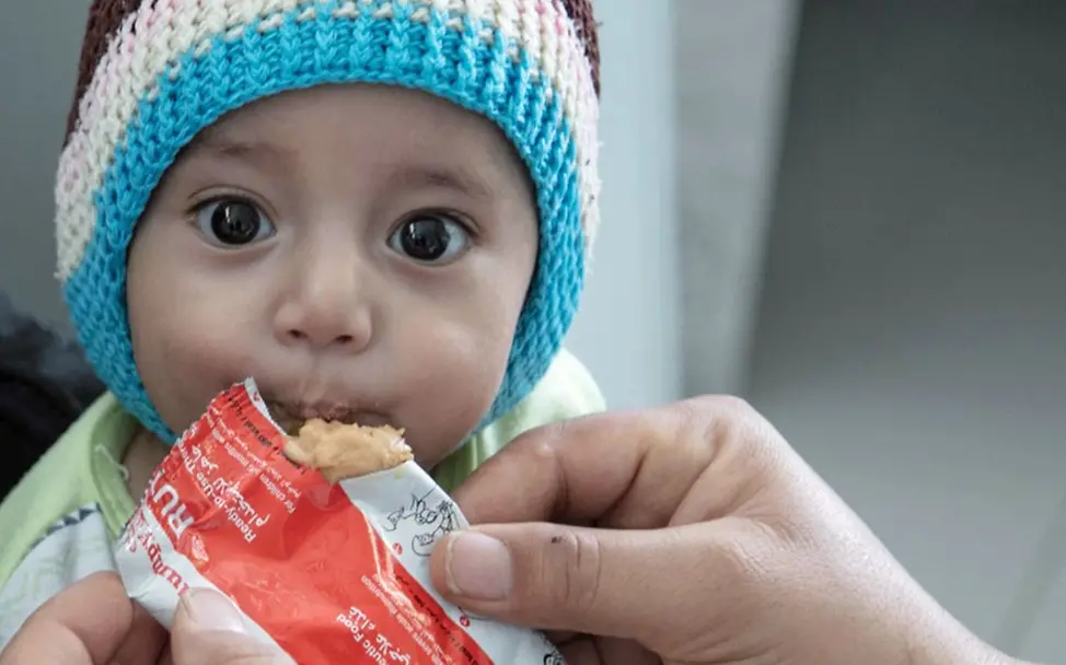 Jemen: Kampf gegen die drohende Hungersnot. UNICEF hilft unterernährten Kindern. | © UNICEF/UNI341612/ Ein mangelernährtes Kleinkind im Jemen bekommt Erdnusspaste gegen den Hunger.