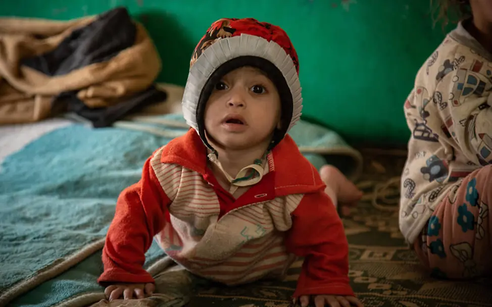 UNICEF: Ein Mädchen im Jemen krabbelt über den Boden.