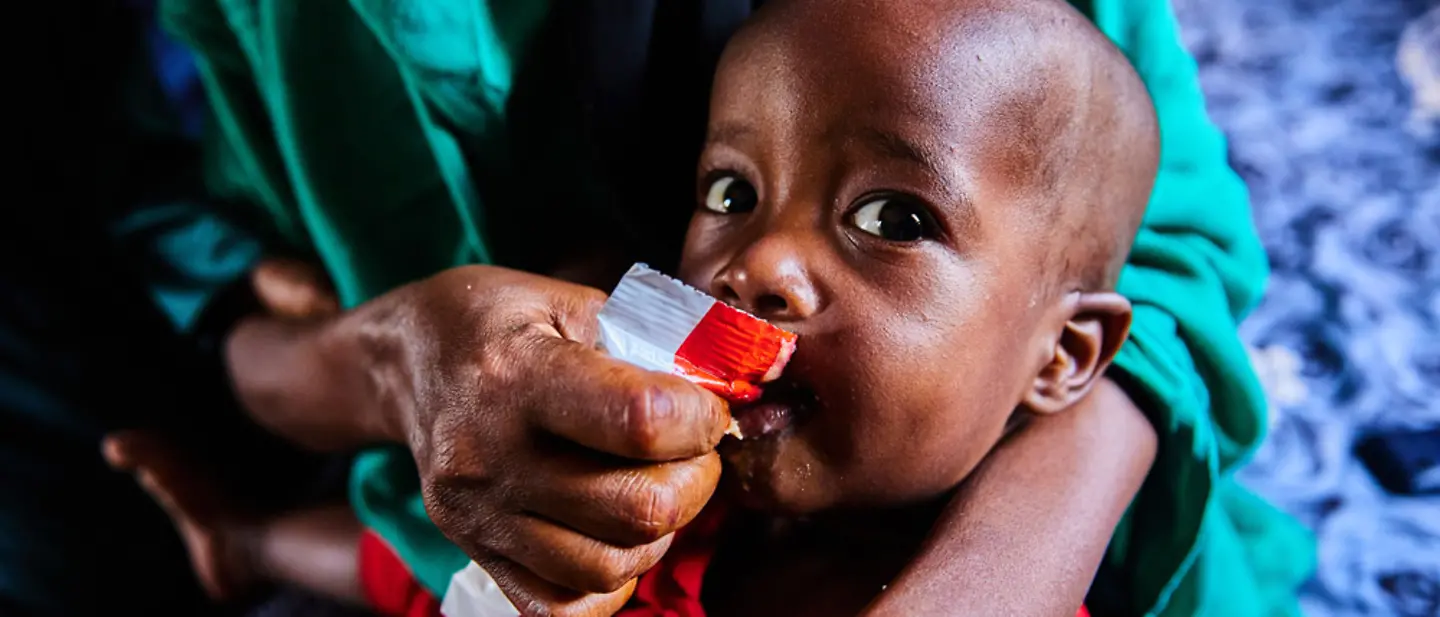 Garissa aus Kenia bekommt Erdnusspaste. | © UNICEF/Orina Kenia: Garissa bekommt Erdnusspaste.