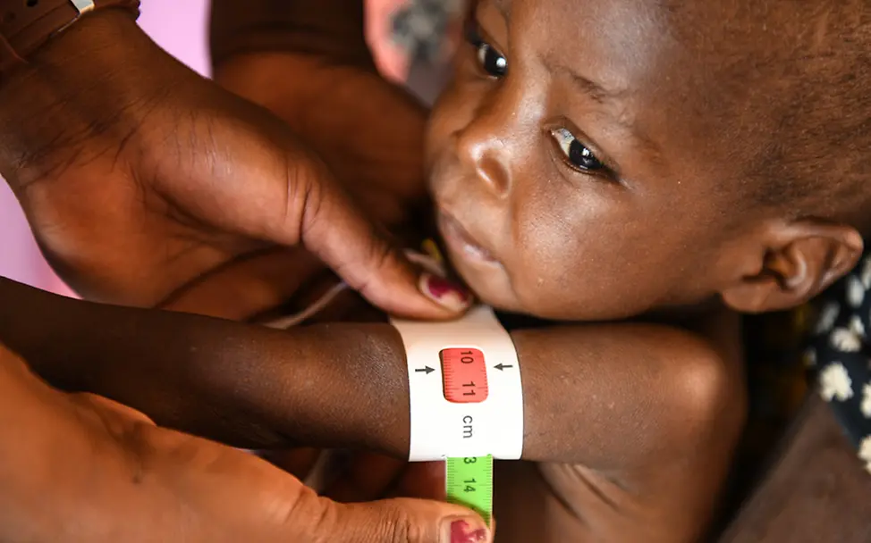 Malawi: Bei einem Kind wird der Armumfang gemessen | © Thoko Chikondi/UNICEF Malawi: Bei einem Kind wird der Armumfang gemessen