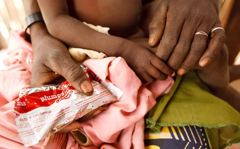 Erdnusspaste rettet Leben Erdnusspaste rettet Leben