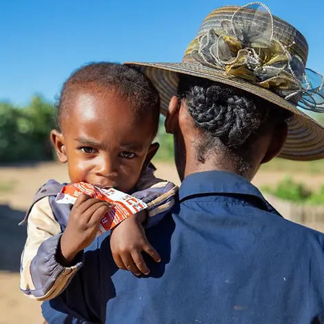 Gegen seine Mangelernährung erhält dieser Junge stärkende Erdnusspaste. | © UNICEF/Ralaivita Hunger weltweit - Kampf gegen den Welthunger: Ein Junge in Madagaskar bekommt Erdnusspaste gegen Unterernährung.