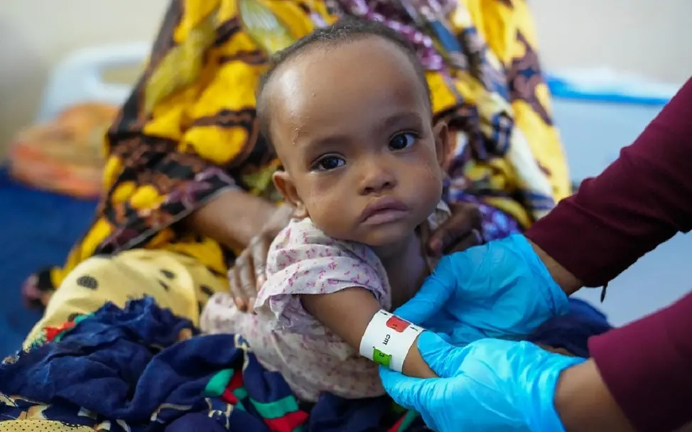 Drohende „Explosion der Kindersterblichkeit" am Horn von Afrika |© UNICEF/UN0644285/Fazel Somalia: Ein Kind wird mithilfe eines Maßbandes auf Mangelernährung untersucht