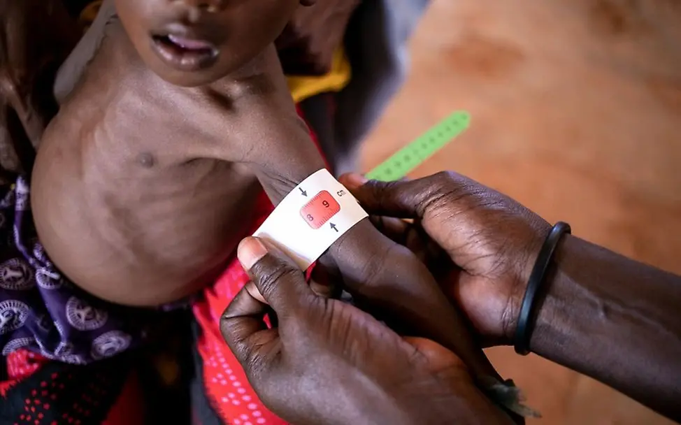 G7-Gipfel 2022 Kindersterblichkeit durch Mangelernährung in Afrika