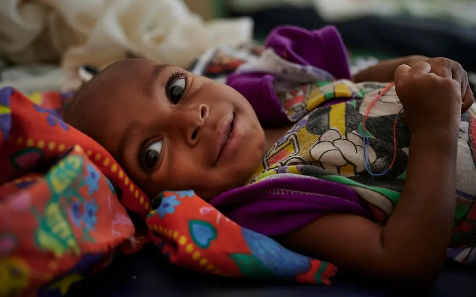 Ali Abubakar erholt sich von schwerer Mangelernährung. | © UNICEF/Noorani Ein Kind liegt in einem Bett.