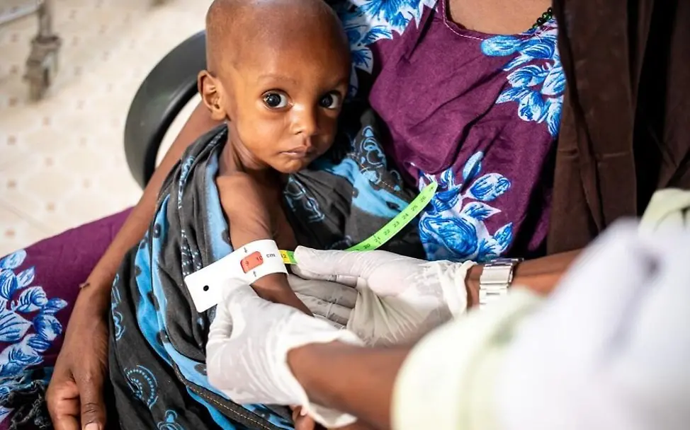 In Somalia benötigen aktuell schätzungsweise 386.000 schwer akut mangelernährte Kinder dringend eine Behandlung. | © UNICEF/Taxt Ein mangelernährtes Kind auf dem Arm seiner Mutter.