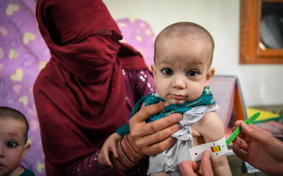 Afghanistan Kinder: Ein Junge wird mit einem Maßband auf Mangelernährung untersucht | © UNICEF/Karimi Afghanistan Kinder: Ein Junge wird mit einem Maßband auf Mangelernährung untersucht