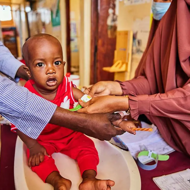 In Kenia herrscht eine schwere Hungerkrise. Kinder kämpfen ums Überleben. | © UNICEF/Orina Kenia Hunger: Ein Baby wird auf Mangelernährung untersucht. In Kenia herrscht eine Hungerkrise.