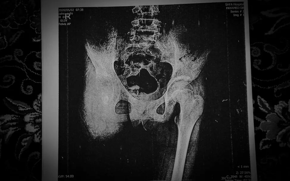 Iran: Two Wings of a Butterfly