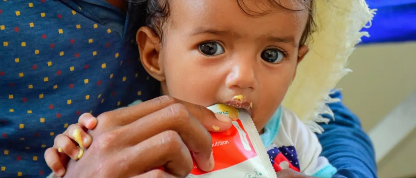 UNICEF hilft mangelernährten Kindern im Jemen mit therapeutischer Nahrung. | © UNICEF/Gabreez Jemen Hungersnot verhindern: Ein mangelernährtes Baby wird mit Spezialnahrung gegen den Hunger gefüttert.