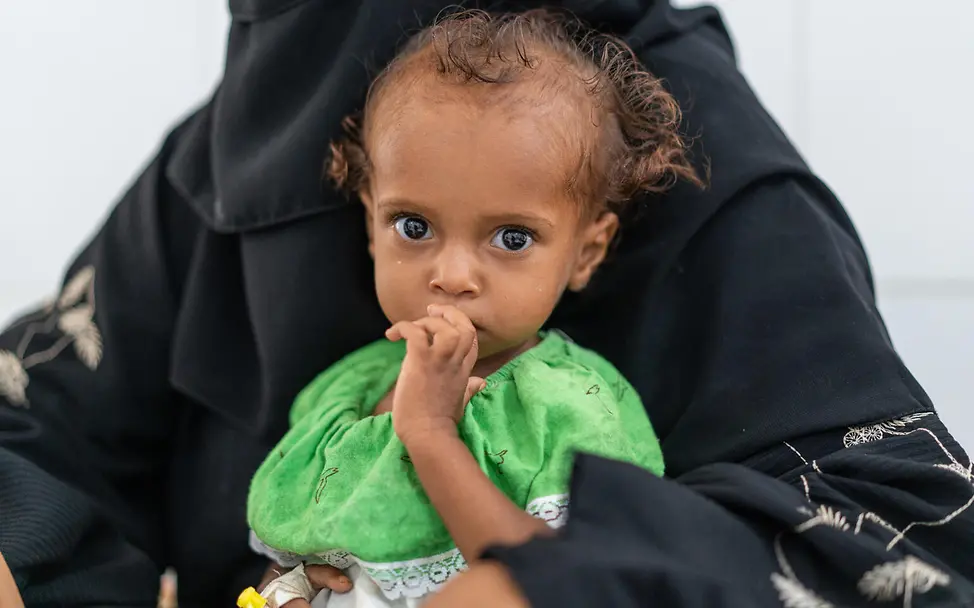 Jemen: Das 18 Monate alte Mädchen Gosson war schwer mangelernährt | © UNICEF/Hayyan Jemen: Das 18 Monate alte Mädchen Gosson war schwer mangelernährt
