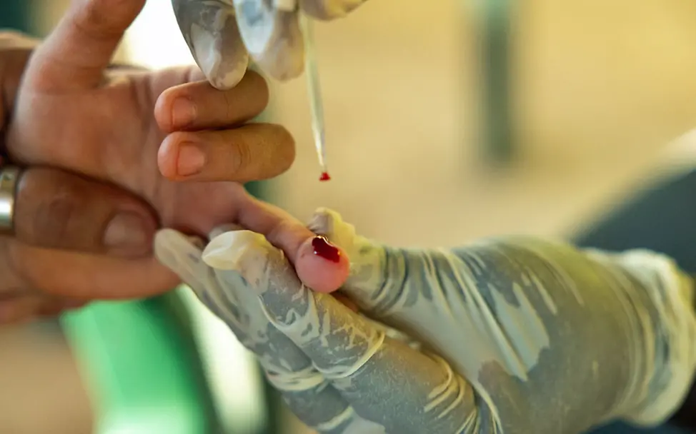 Eine Gesundheitshelferin entnimmt für einen Malaria-Test Blut aus einem Finger | © UNICEF/Slingshot Malaria-Impfungen können keine traditionelle Malaria-Diagnostik und -Prophylaxe ersetzen