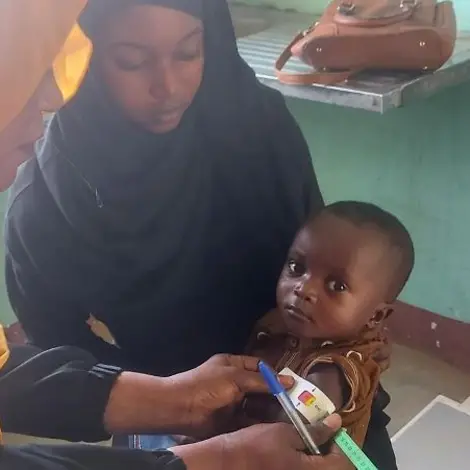 Ein Kind aus dem Sudan wird untersucht. | © UNICEF/UN0835939/Elamin Zur Behandlung geen Mangelernährung wird vorab der Ernährungszustand des Kindes festgestellt.