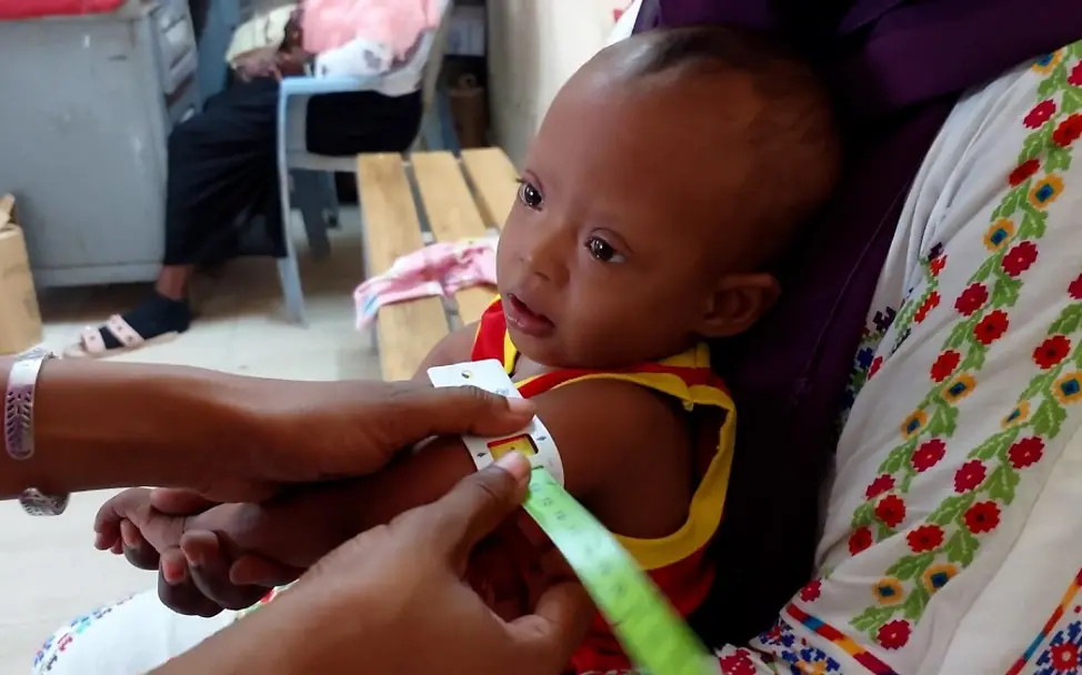 | UNICEFHasouna Hunger und Mangelernährung im Sudan