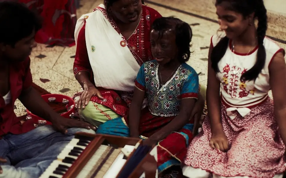 Sandra Thier bei der Acid Survivors Fundation. ©Steven Pan/UNICEF/RTL II