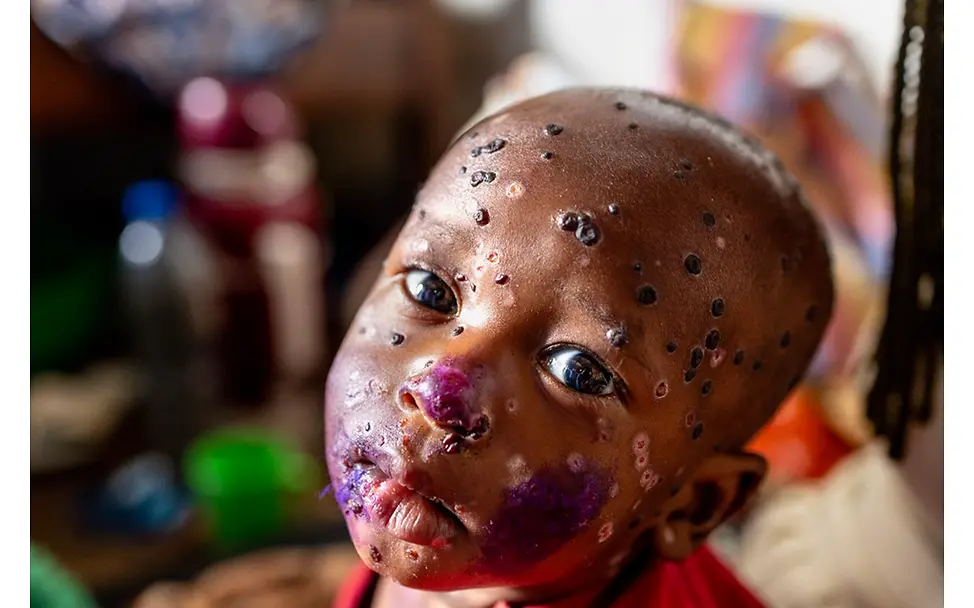 Der zweite Preis | Pascal Maitre UNICEF Foto des Jahres 2024