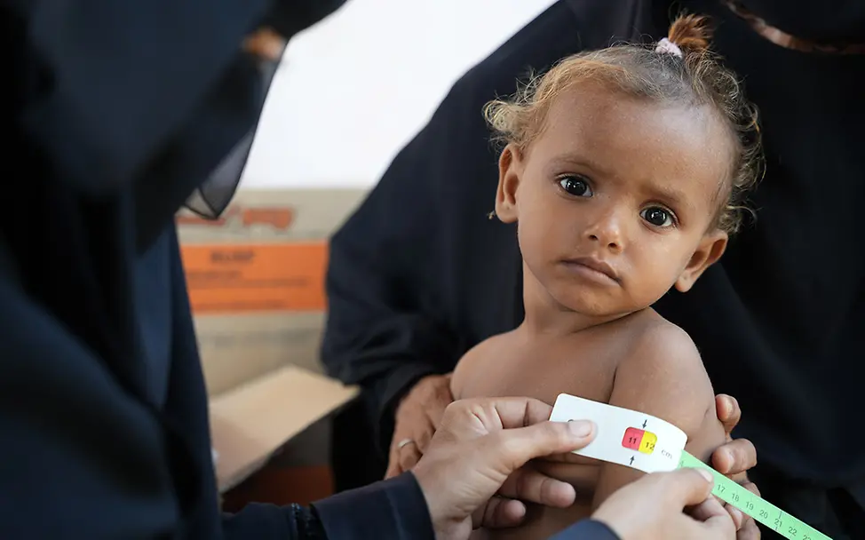 Hunger im Jemen: Tausende Kinder sind mangelernährt und brauchen Spezialnahrung