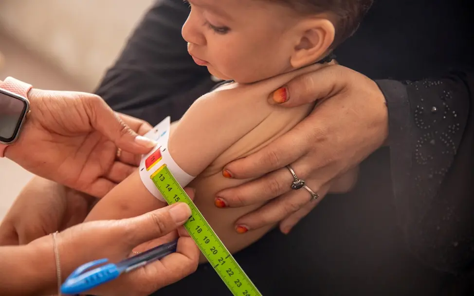 Afghanistan: Majid (1) leidet an Mangelernährung. Krise in Afghanistan: Jetzt helfen