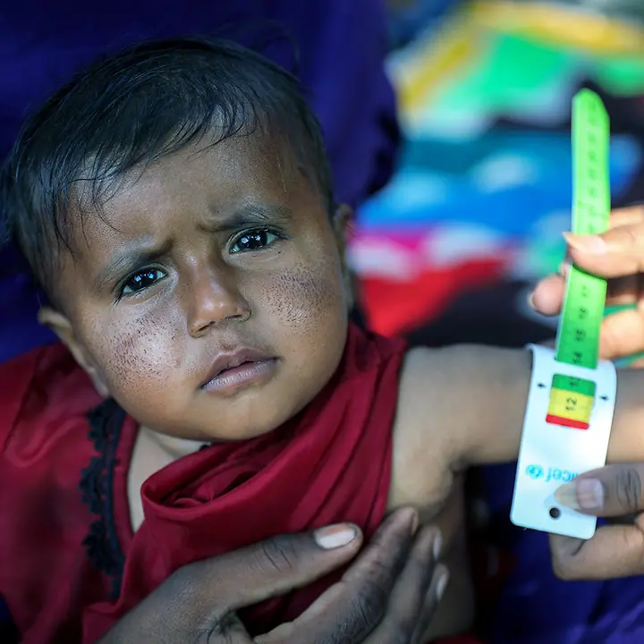 Hunger in der Welt: Ein Kleinkind in Pakistan wird auf Mangelernährung getestet 