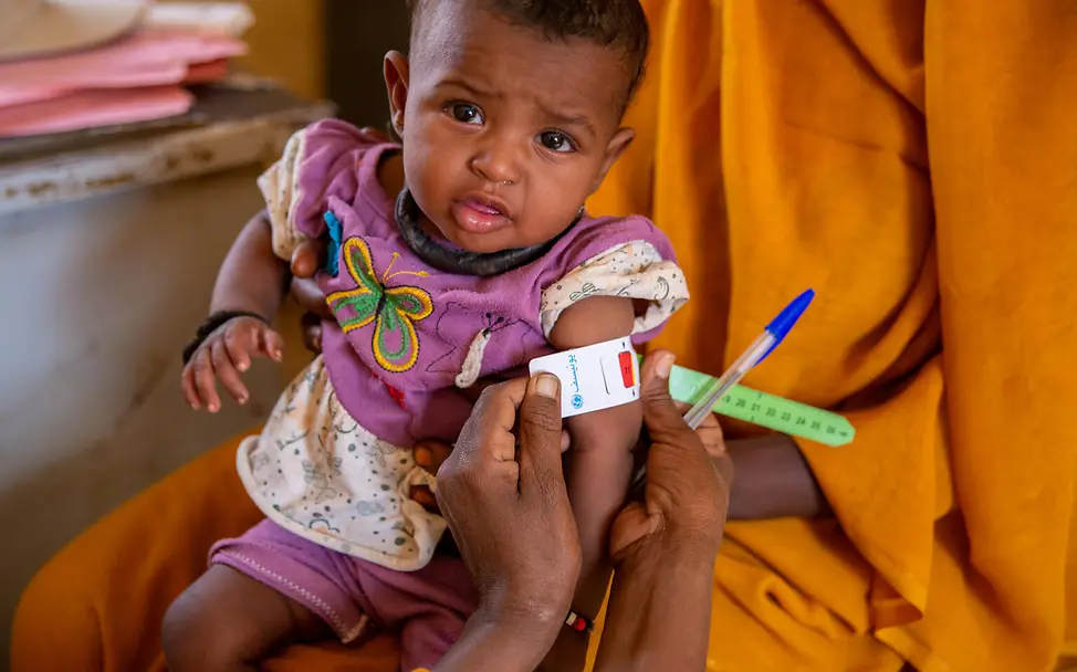 Hunger in der Welt: Mangelernährte Babys und Kleinkinder brauchen unsere Hilfe, um zu überleben. 