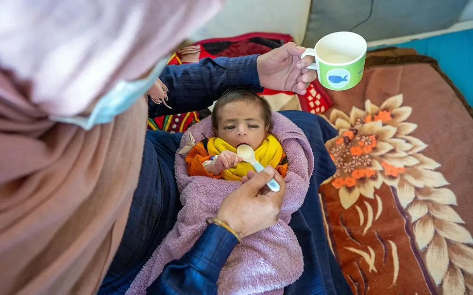 Afghanistan Kinder: Ein mangelernährtes Baby bekommt Spezialmilch
