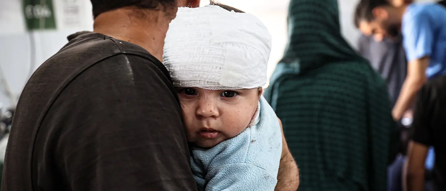 Ein im Gazastreifen bei einem Luftangriff verletztes Baby | © UNICEF/El Baba Gaza spenden: Viele palästinensische Kinder wurden seit Kriegsbeginn getötet und verletzt. Viele leiden Hunger.