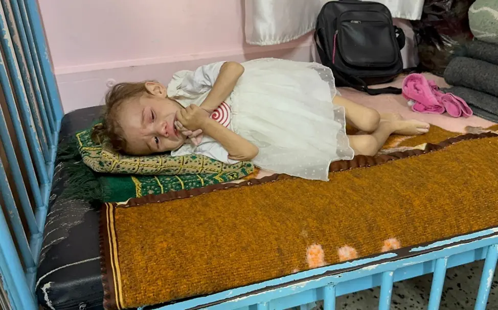 Erkärlog Hungersnot: Mariam (2) liegt in einem Bett im Krankenhaus im Gazastreifen.