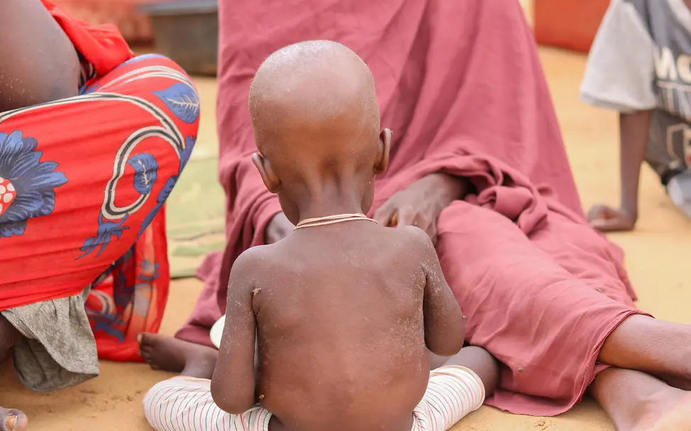 Im Sudan wurde eine Hungersnot ausgerufen. I © UNICEF/UNI849403/UNICEF Ein stark unterernährtes Kind wird gefüttert. Hilfsgüter sind für die Menschen in Sudan extrem wichtig.