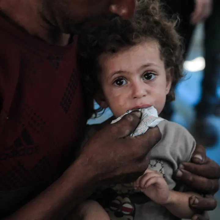 News Gaza: Rund 26.000 Kinder im Gazastreifen benötigen dringend eine Behandlung wegen Mangelernährung