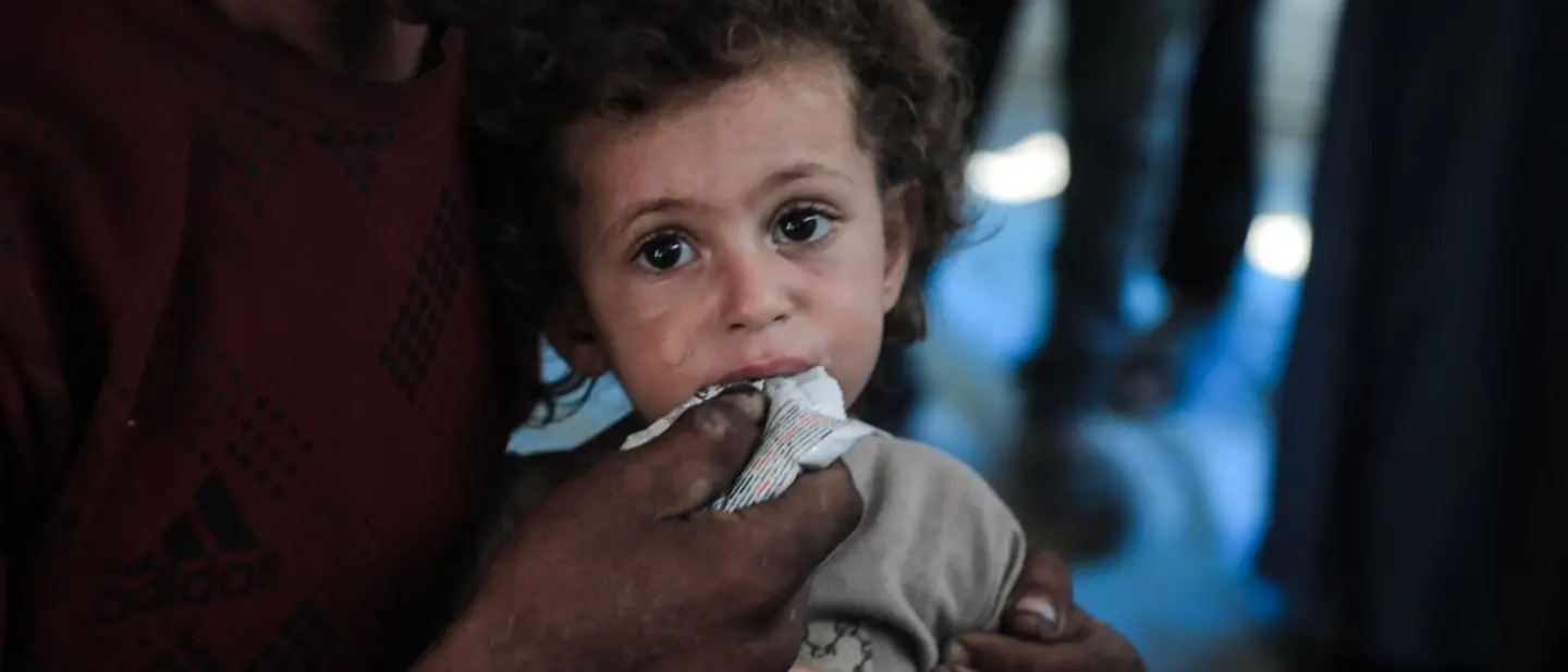 News Gaza: Rund 26.000 Kinder im Gazastreifen benötigen dringend eine Behandlung wegen Mangelernährung