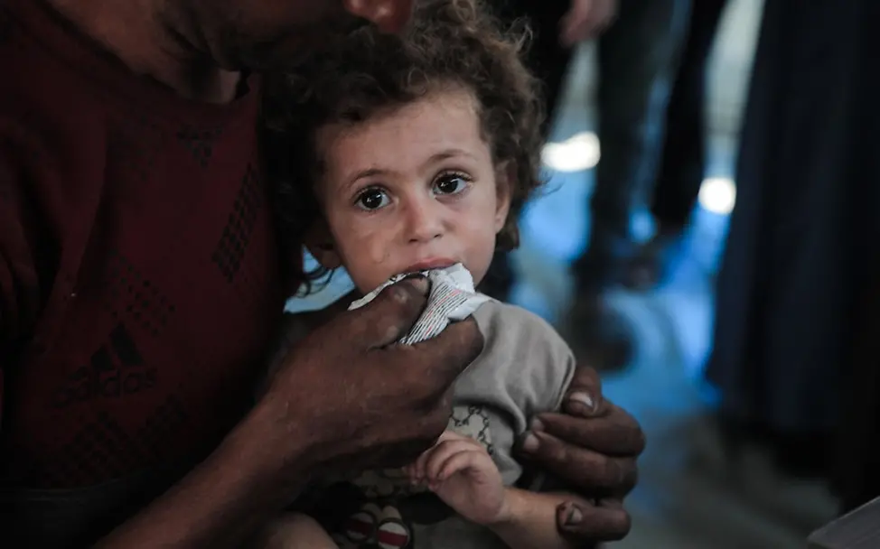 News Gaza: Rund 26.000 Kinder im Gazastreifen benötigen dringend eine Behandlung wegen Mangelernährung