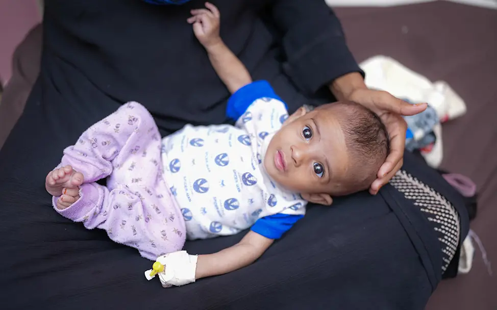 Jemen: Ein unterernährtes Baby im Schoß der Mutter.