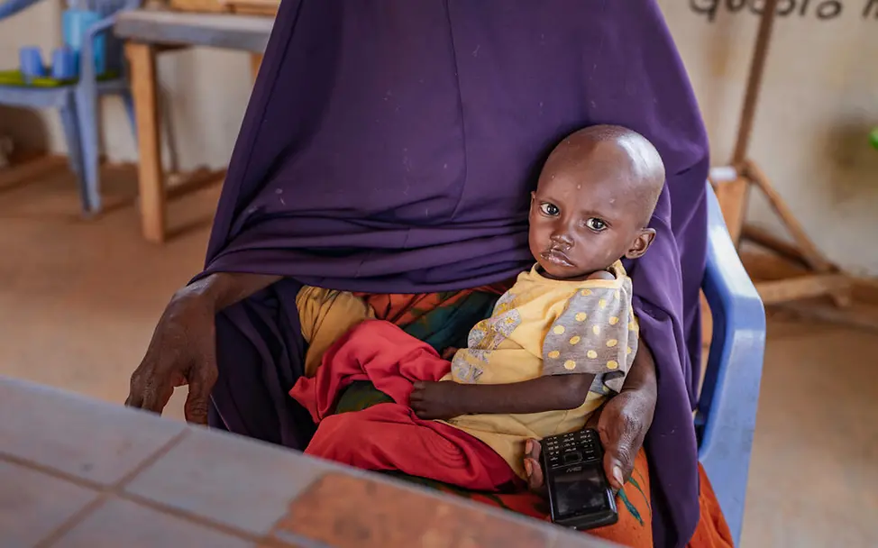 Somalia Hungerkrise: Ein mangelernährtes Kleinkind wartet auf Behandlung.