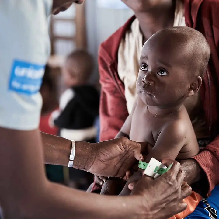 Madagaskar Hungerkrise: Ein Baby wird auf Mangelernaehrung untersucht.