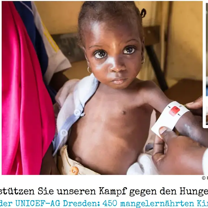 Aufruf, um gemeinsam Leben zu retten – gegen Mangelernährung mit UNICEF
