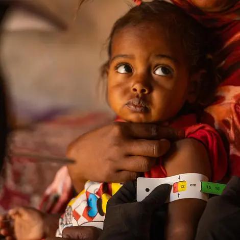 Sudan Hungersnot: Oberarmmessung bei Mädchen