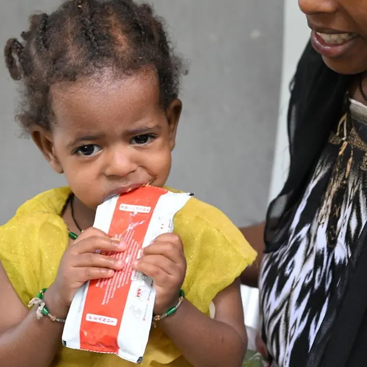 Hunger in Afrika: Äthiopien | © UNICEF/Dejongh Schutz vor Hungersnot: Ein Kind in Afrika erhält therapeutische Erdnusspaste zur Behandlung von Mangelernährung.