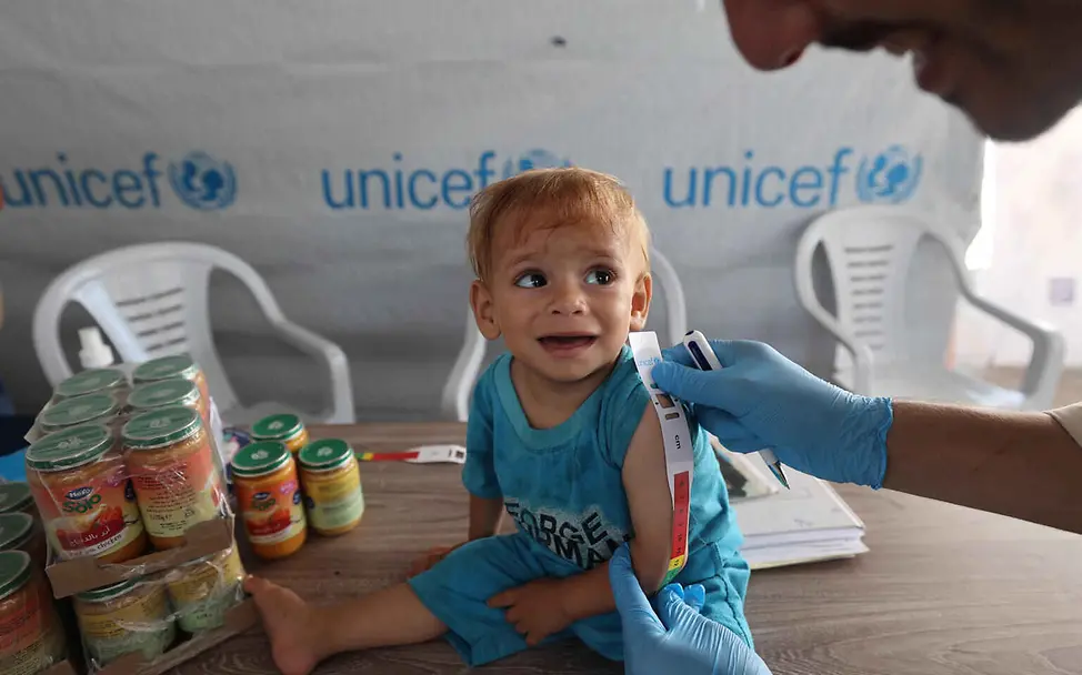 Mit Spezialnahrung und Medikamenten hilft UNICEF mangelernährten Kindern in Kriegsgebieten. | © UNICEF/Ba Was ist Krieg einfach erklärt: Ein Kleinkind sitzt auf einem Tisch und wird auf Mangelernährung untersucht.